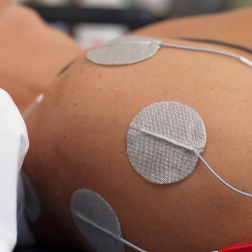 neuromuscular-electrical-stimulation-Flowstate-Physical-Therapy-Tuscaloosa-AL